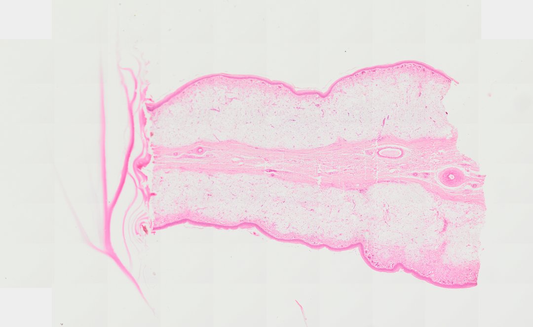 Microscope slide: Rooster Comb (Cross Section)