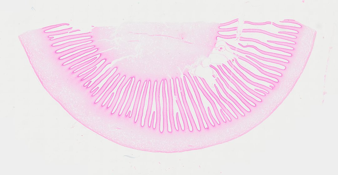 Microscope slide: Mushroom Gills (Cross Section)