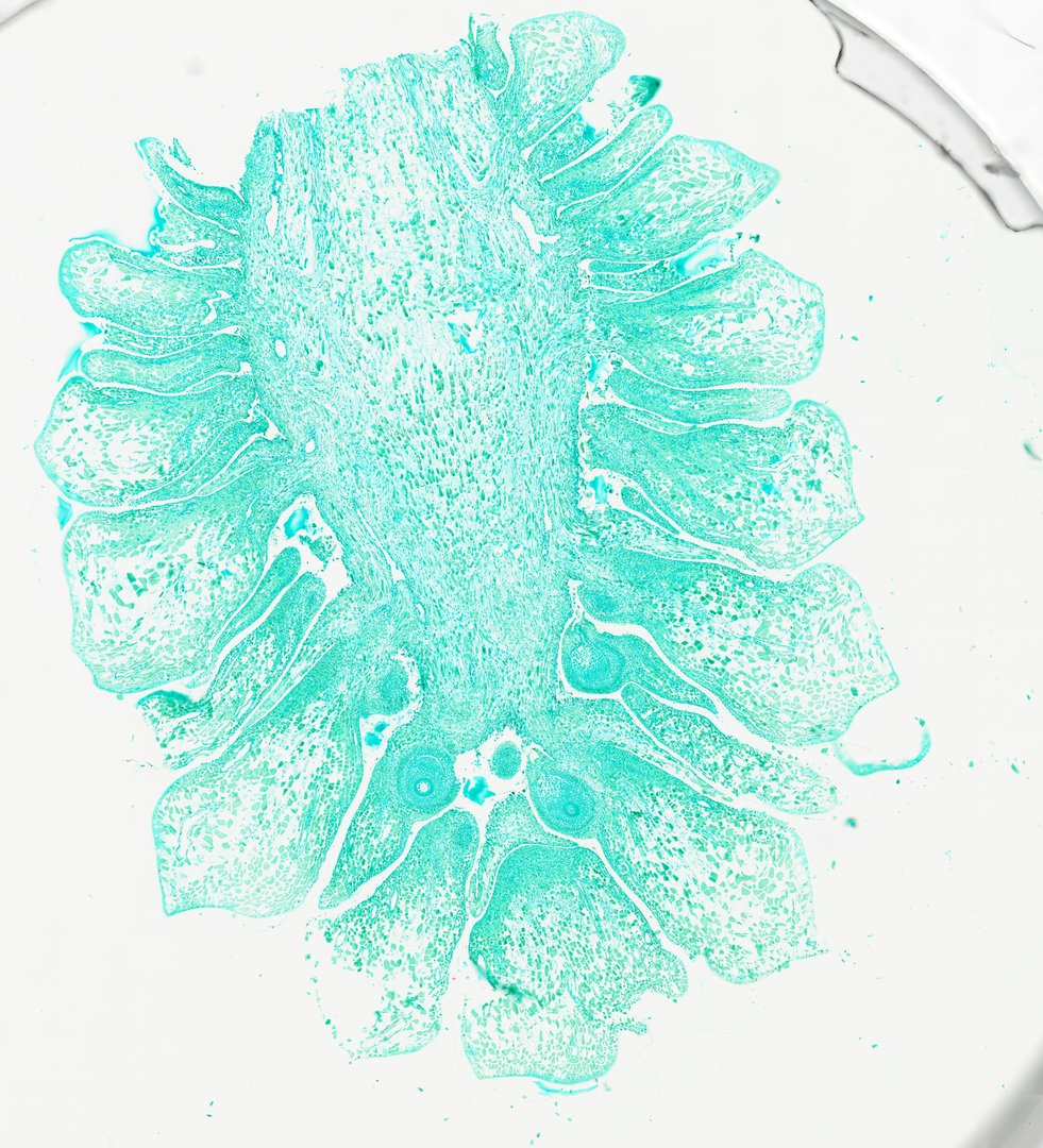 Microscope slide: Pine Cone Female (Longitudinal Section)