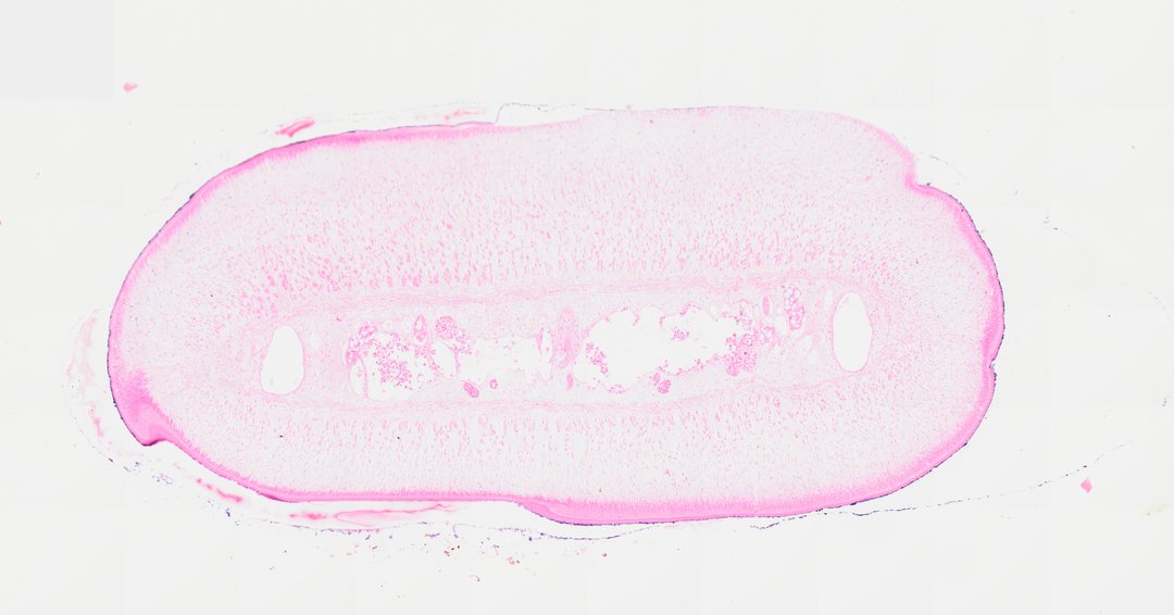 Microscope slide: Taenia Pisiformis (Cross Section)