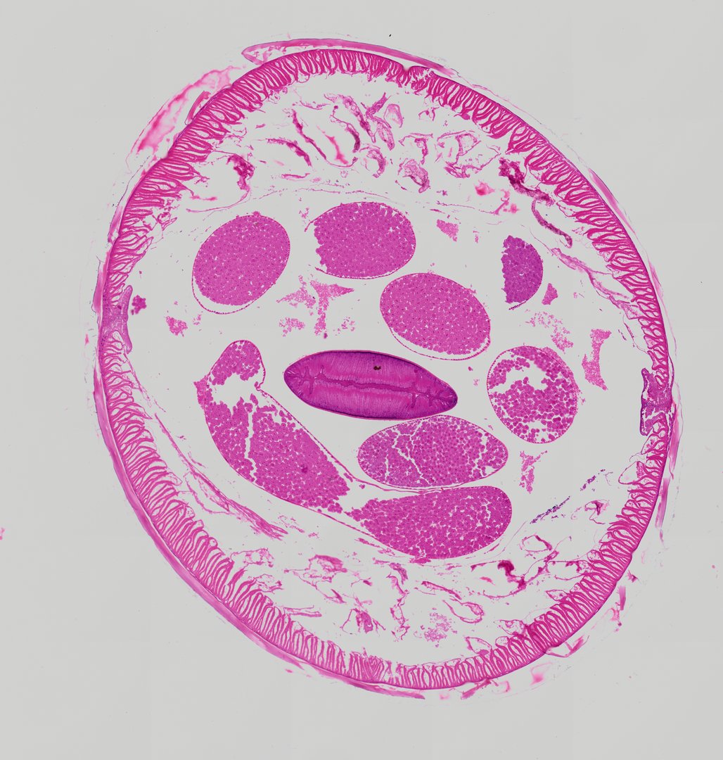 Microscope slide: Ascaris Male (Cross Section)