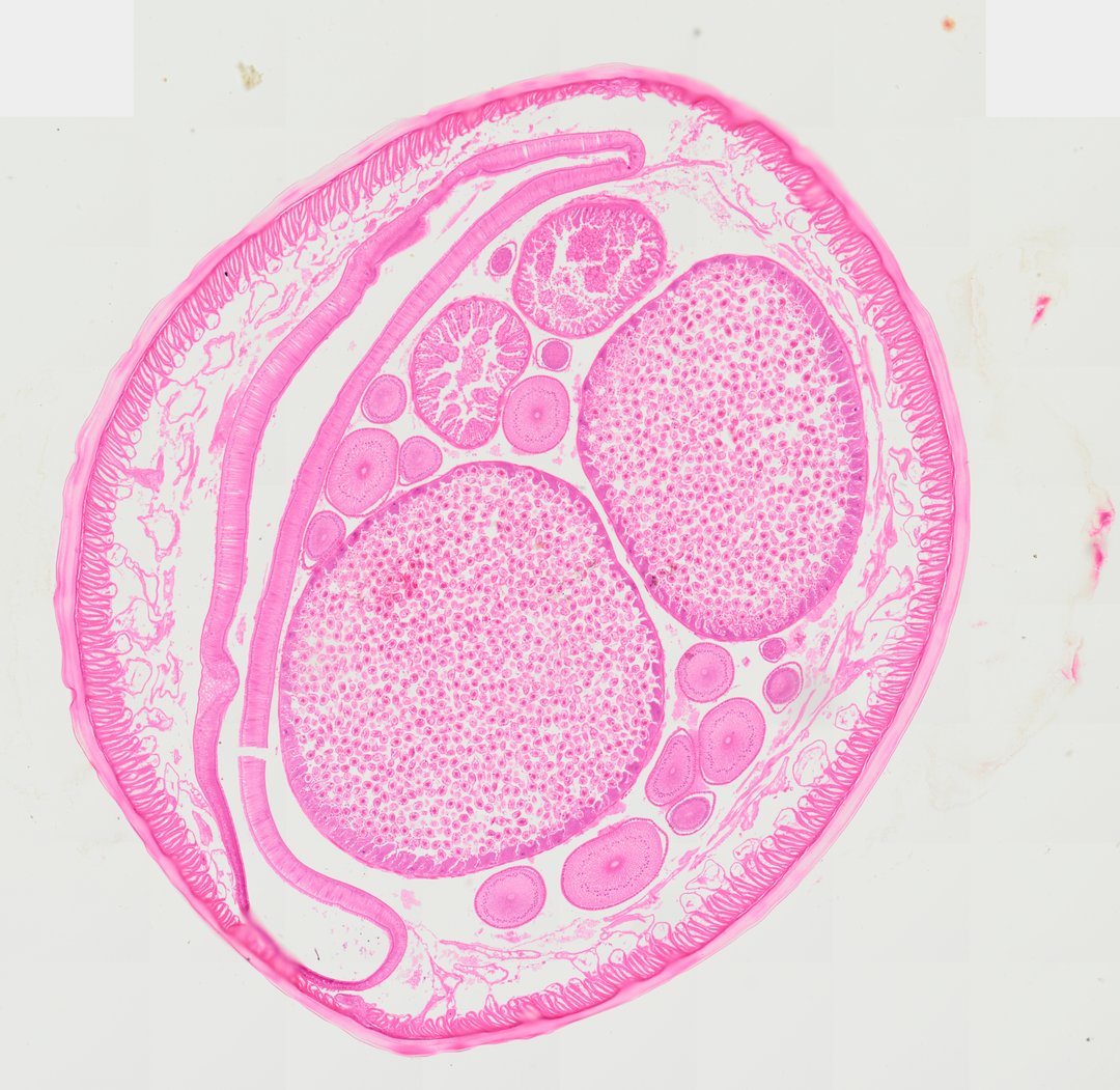 Microscope slide: Ascaris Female (Cross Section)
