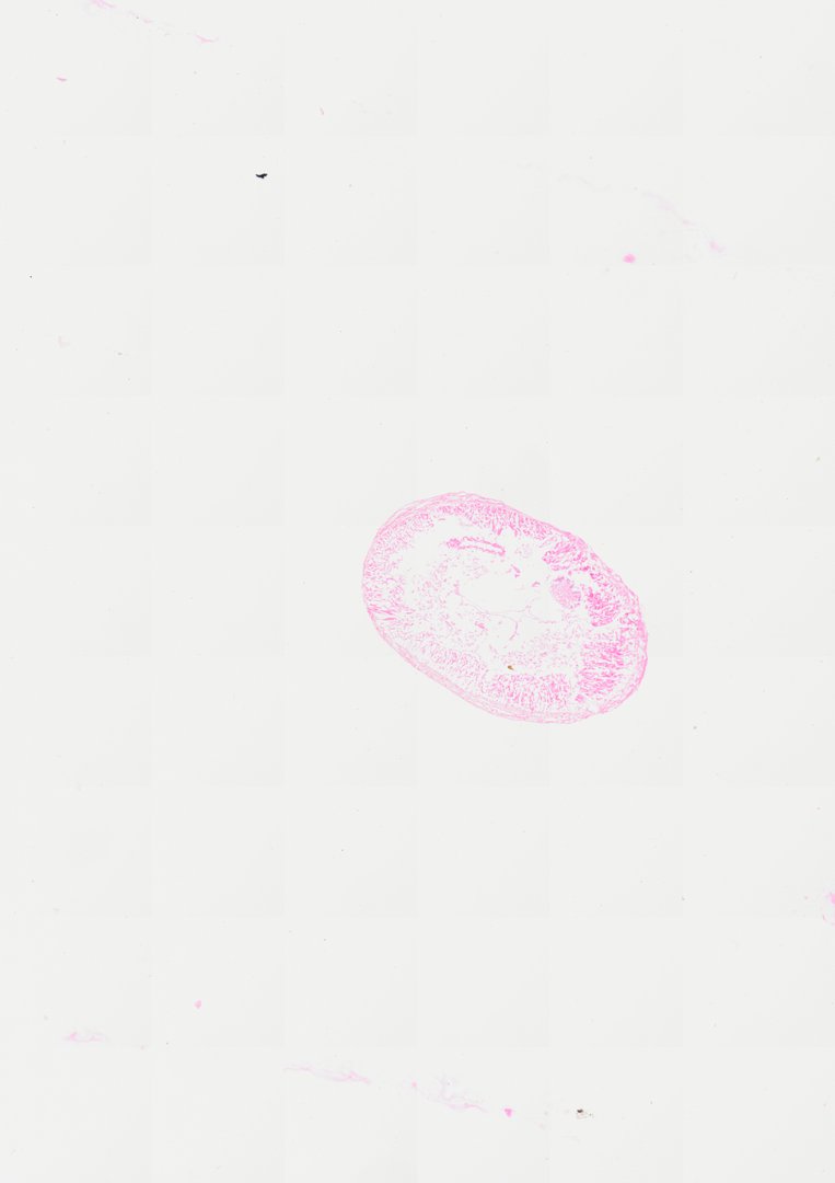 Microscope slide: Earthworm (Cross Section)