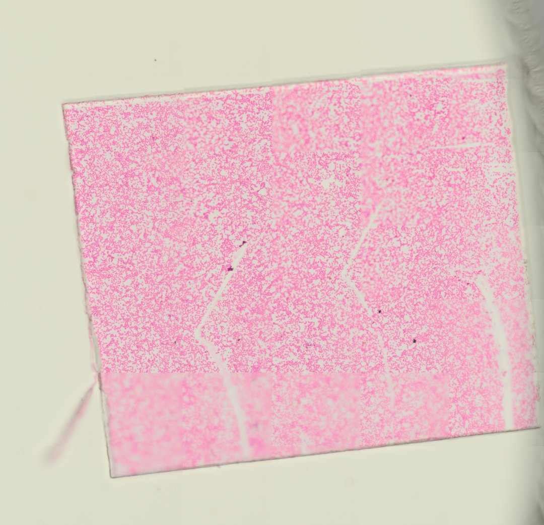Microscope slide: Human Blood Smear