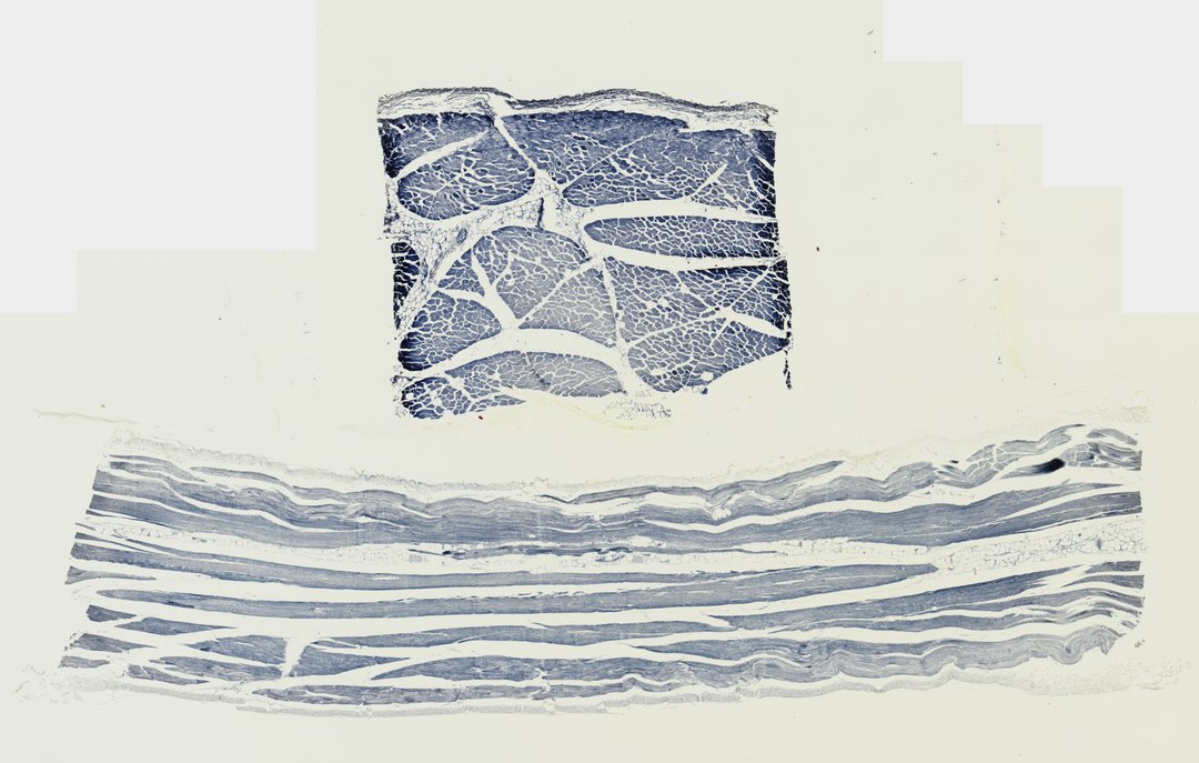 Microscope slide: Skeletal Muscle (Transverse & Longitudinal Section)
