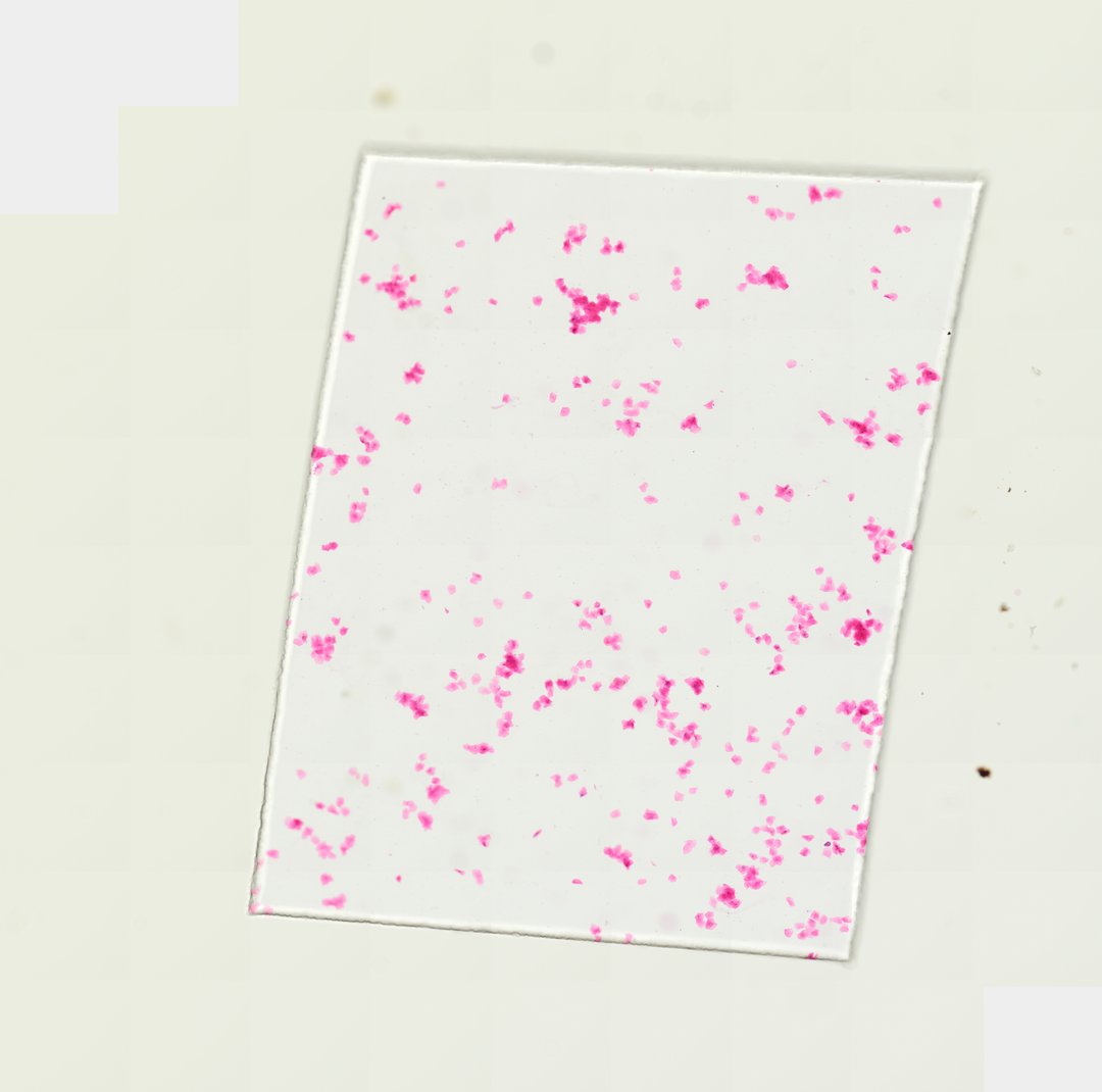 Microscope slide: Oral Epithelial Cells (Whole Mount)