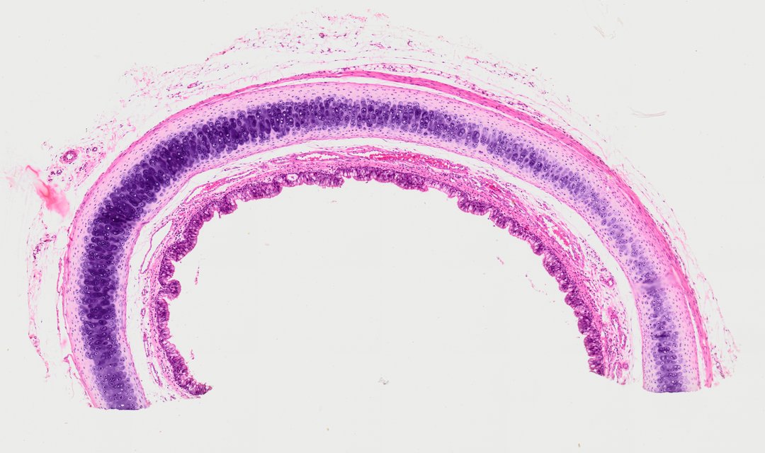 Microscope slide: Bone Cell (Hyaline Cartilage / Trachea Section)