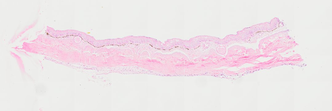 Microscope slide: Frog Epidermic Cell (Cross Section)