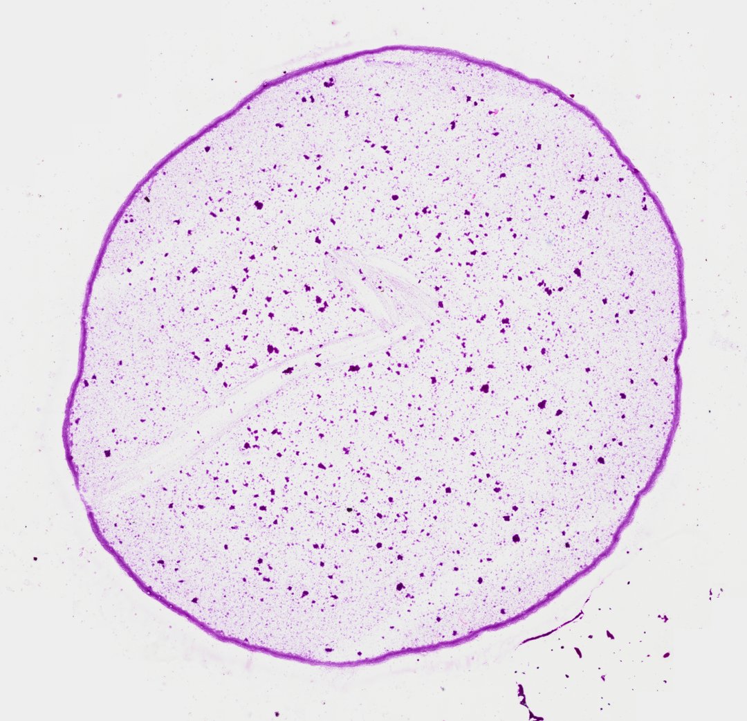 Microscope slide: Three Types of Bacteria Smear