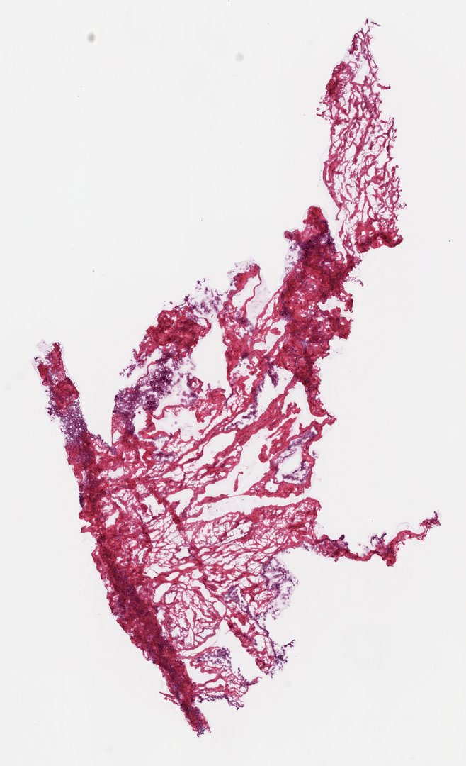 Microscope slide: Ovary  (top section)