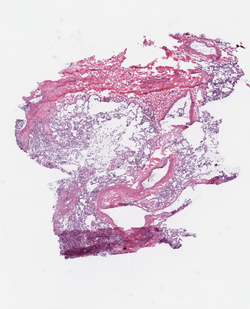 Microscope slide: Lung (top section)