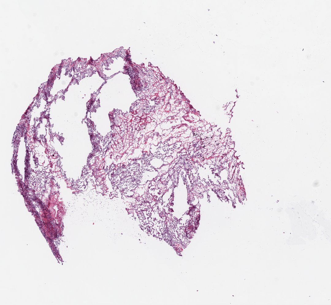 Microscope slide: Lung (top section)