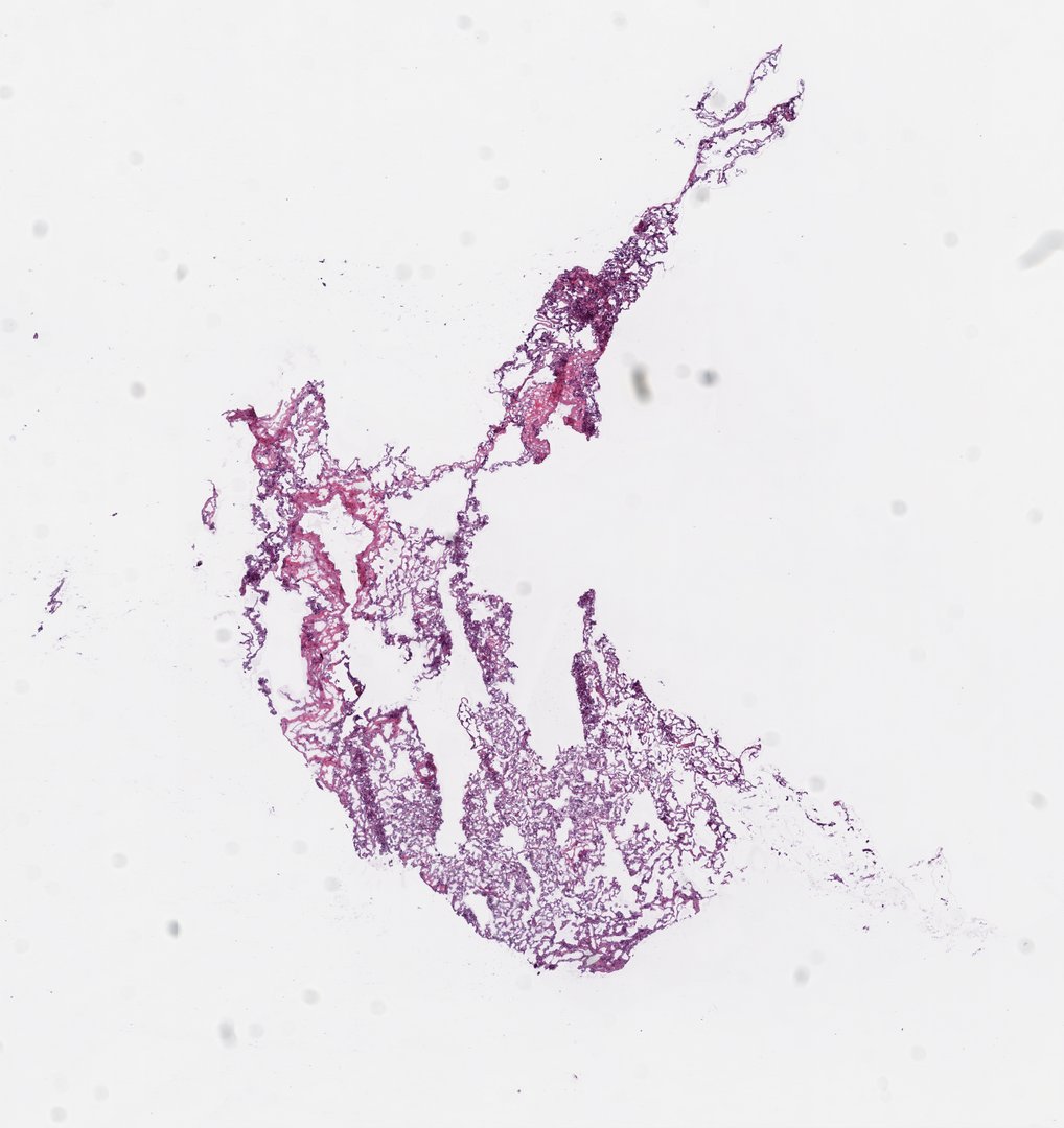 Microscope slide: Lung (bottom section)