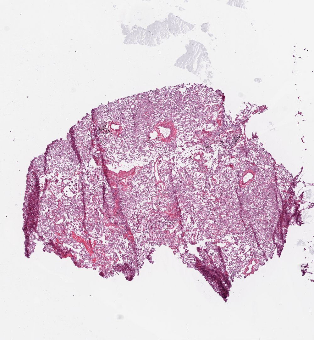 Microscope slide: Lung (top section)