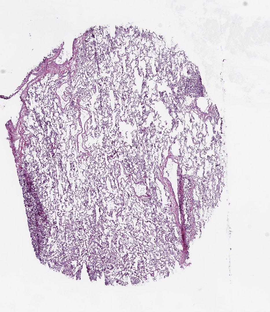 Microscope slide: Lung (top section)