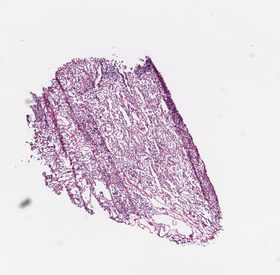 Microscope slide: Lung (bottom section)